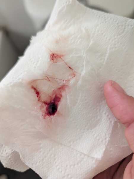 Blood clots from nose [graphic photo included]