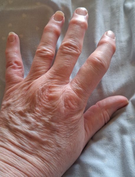 My hands age me!