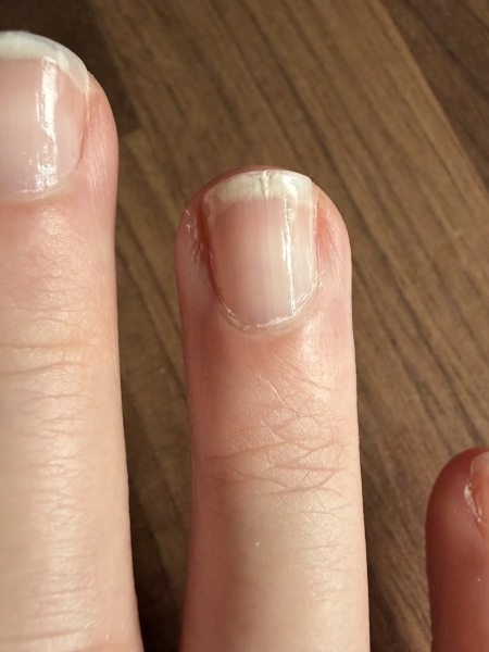 Can this nail be saved or do I just have to cut it down?