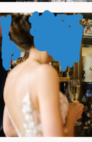 To think that this person is developing a hunchback?