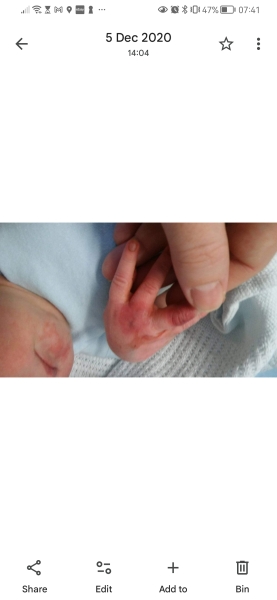 Accused of harming my baby while doctors investigate high calcium levels
