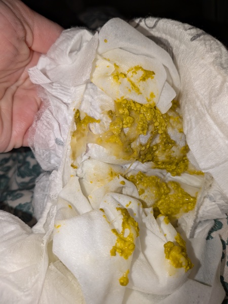 Is this poo and feeding behaviour normal for a 6 week old?