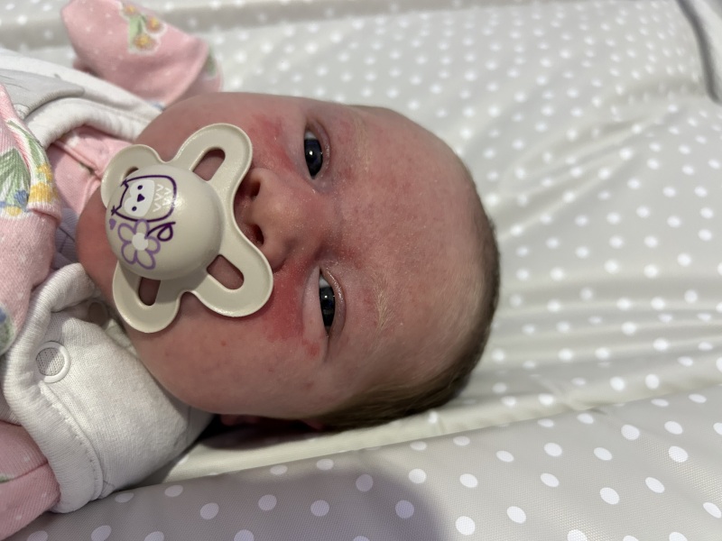 Rash that just won’t disappear, help?!