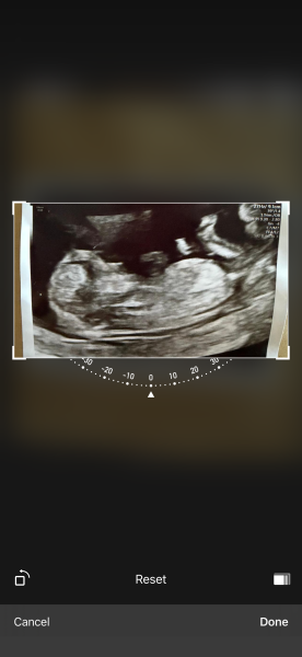 12 scan can you help me guess the gender 💙💖