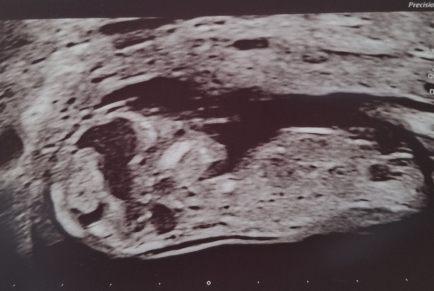 If you have a moment..13 week scan, baby kept moving and angling away 😅 so each pic looks so different. Gender guesses please 🙏 🙂 💕