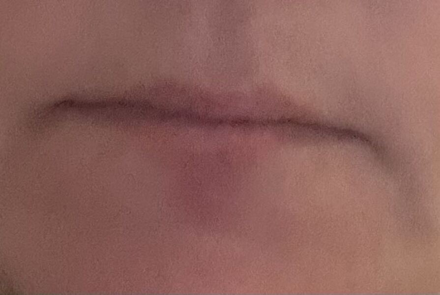 Does anyone know what this is under my bottom lip? (Pic included)