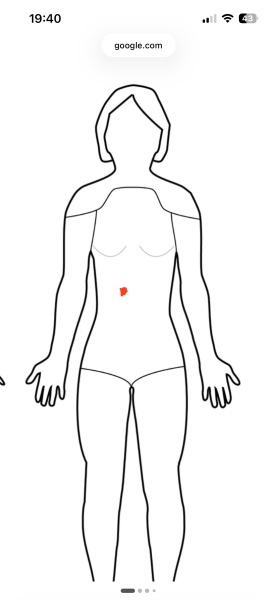 Upper right abdominal pain (dull pain) and strange smelling wee.