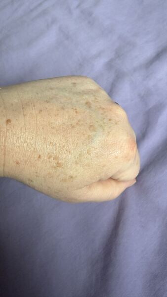 My hands age me!