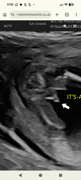 Definitely a boy?