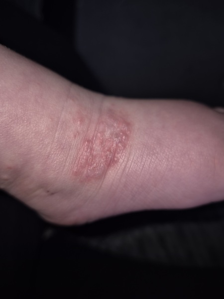 Do I just go to A&E at this point?