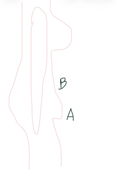 Shape wear for specific lower belly problem area