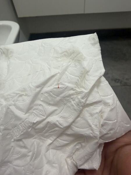 Red tiny spec when wiping!? 8weeks pregnant