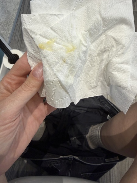 Normal discharge - 7 weeks?