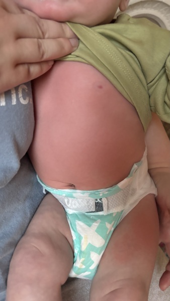 GP ignoring allergy concerns