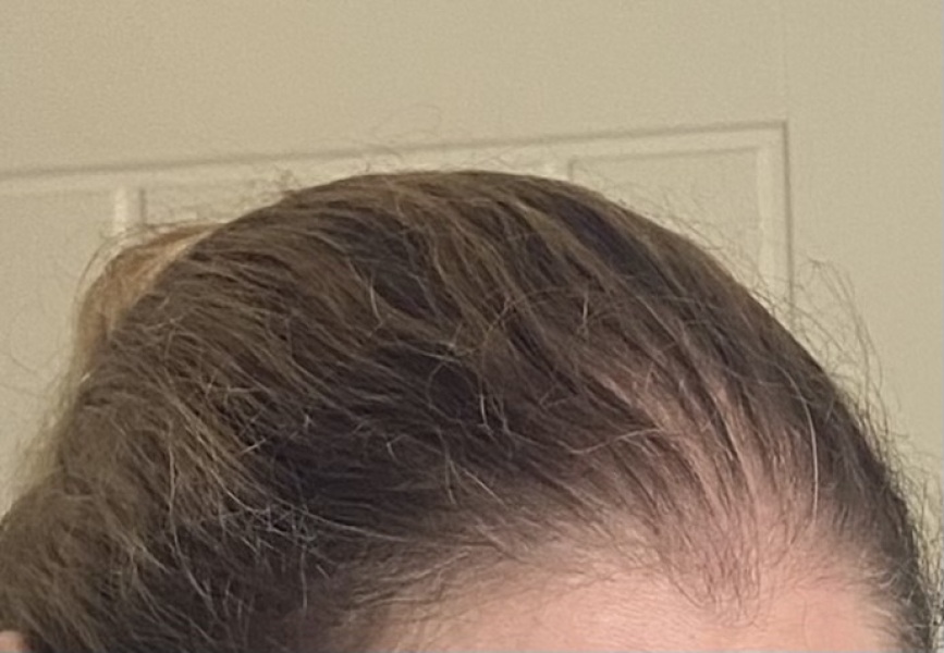 Help, dyed hair orange before sons christening!
