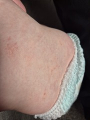 Do I just go to A&E at this point?