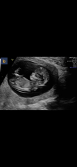 Gender thoughts / nub theory predictions