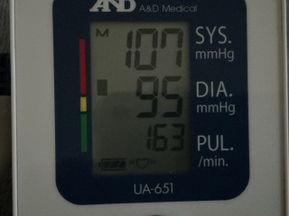 Please help! Mystery illness/unexplained symptoms RUINING MY LIFE. SO scared