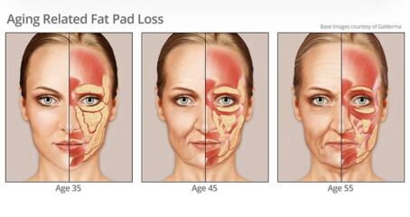 Having facelift surgery in 10 days - support and advice needed