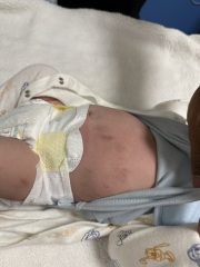 Accused of harming my baby while doctors investigate high calcium levels