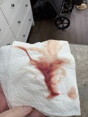 Attending triage too much? *trigger warning pictures*