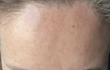 Do some people genuinely not notice their own lines and wrinkles?