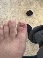 Sorry for the picture