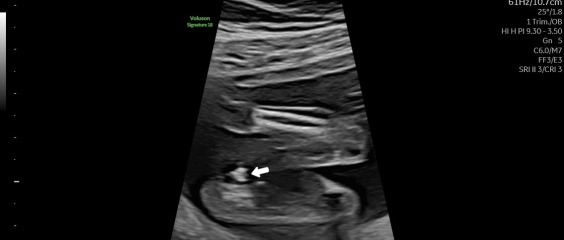 Unsure about gender scan result after conflicting opinions on the images