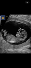 Gender thoughts / nub theory predictions