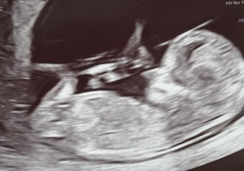 Gender guesses please 🙏 🩷💙