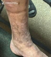 Ukraine Invasion: Part 60