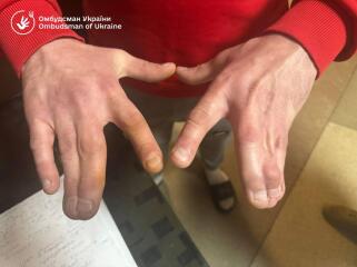 Ukraine Invasion: Part 60