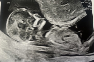 Another Day, Another Nub Guess!