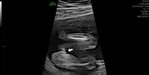 Unsure about gender scan result after conflicting opinions on the images