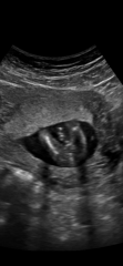16-week scan: does this look like a boy to others?