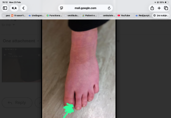 Please help! Mystery illness/unexplained symptoms RUINING MY LIFE. SO scared