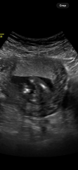 16-week scan: does this look like a boy to others?