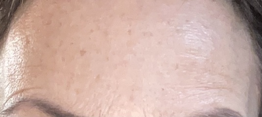 Do some people genuinely not notice their own lines and wrinkles?