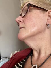 Mounjaro - 10 Stone or more to lose - Thread 13