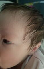 1 month old blood shot eye