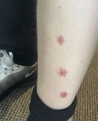 Anyone know what this is on my son