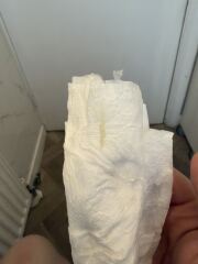 7w2d Pregnant. Yellowish discharge?