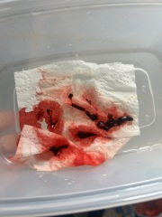 Bleeding and unclear dates in early pregnancy, looking for others' experiences [pics included]