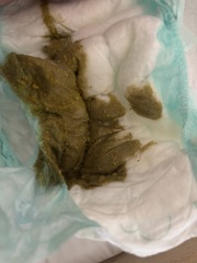 GP ignoring allergy concerns