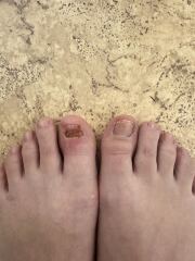 Sorry for the picture