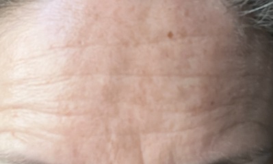 Do some people genuinely not notice their own lines and wrinkles?