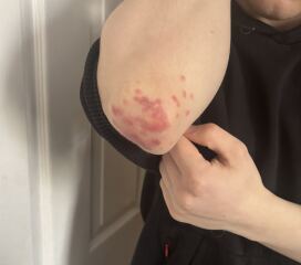 Anyone know what this is on my son