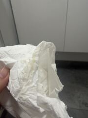 7w2d Pregnant. Yellowish discharge?