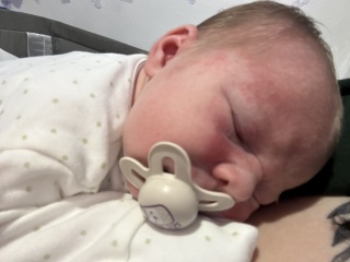 Rash that just won’t disappear, help?!