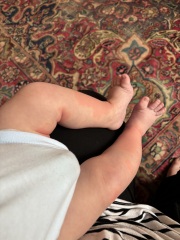 GP ignoring allergy concerns